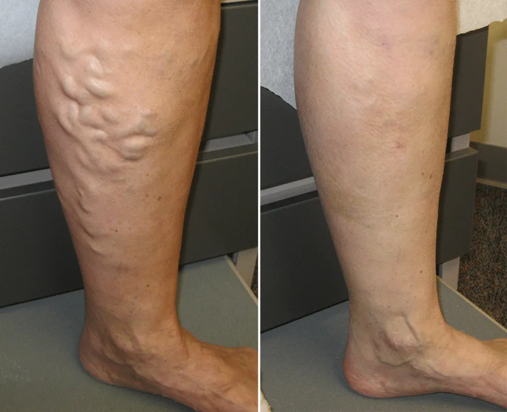 SmoothSpine™ Non-Slip Sleep Socks
